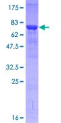 SDS-PAGE Recombinant Human IRAK4 GST (N-Term) Protein