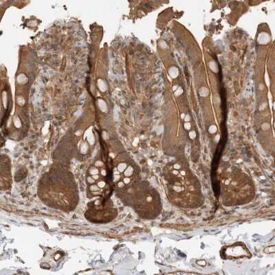 Immunohistochemistry-Paraffin: IRE1 alpha Antibody [NBP2-54680] - Staining of human colon shows strong cytoplasmic and membranous positivity in glandular cells.