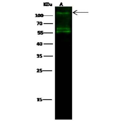 Western Blot: IRE1 alpha Antibody [NBP2-99902] - Anti-IRE1 alpha rabbit polyclonal antibody at 1:500 dilution. Lane A: Raji Whole Cell Lysate. Lysates/proteins at 30 ug per lane. Secondary Goat Anti- Rabbit  IgG H&L (Dylight 800)  at 1/10000 dilution. Developed using the Odyssey technique. Performed under reducing conditions. Predicted band size: 110 kDa. Observed band size: 110 kDa (We are unsure as to the identity of these extra bands).