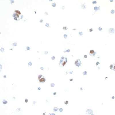 Immunocytochemistry: IRF1 Antibody (BLR039F) [NBP2-76419] - Detection of human IRF1 in FFPE OVCAR-8 cells by ICC. Antibody: Rabbit anti-IRF1 recombinant monoclonal [BLR039F] (NBP2-76419). Secondary: HRP-conjugated goat anti-rabbit IgG. Substrate: DAB.