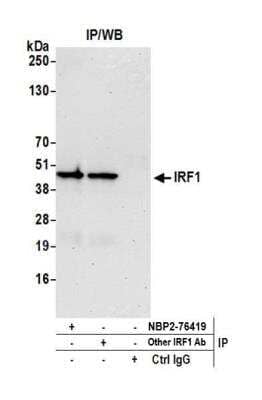 <b>Independent Antibodies Validation. </b>Immunoprecipitation: IRF1 Antibody (BLR039F) [NBP2-76419] - Detection of human IRF1 by WB of immunoprecipitates from Jurkat lysate. Antibodies: Rabbit anti-IRF1 recombinant monoclonal [BLR039F] (NBP2-76419) and another rabbit anti-IRF1 recombinant monoclonal.