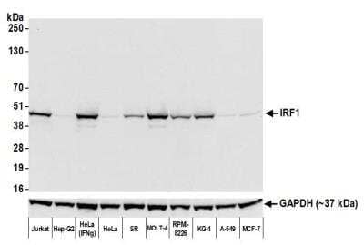 Western Blot: IRF1 Antibody (BLR039F) [NBP2-76419] - Detection of human IRF1 by WB of Jurkat, Hep-G2, HeLa (IFNgamma treated), HeLa, SR, MOLT-4, RPMI-8226, KG-1, A-549, and MCF-7 lysate. Antibody: Rabbit anti-IRF1 recombinant monoclonal [BLR039F] (NBP2-76419). Secondary: HRP-conjugated goat anti-rabbit IgG. Lower Panel: Rabbit anti-GAPDH.