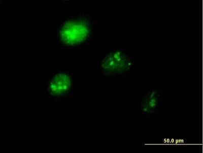 Immunocytochemistry/Immunofluorescence: IRF1 Antibody [H00003659-B01P] - Analysis of purified antibody to IRF1 on HeLa cell. (antibody concentration 10 ug/ml)