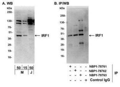 Western Blot: IRF1 Antibody [NBP1-78763] - Whole cell lysate from NIH3T3 (M; 15 and 50 mcg for WB; 1 mg for IP, 20% of IP loaded) and Jurkat (J; 50 mcg) cells.   Affinity purified rabbit anti-IRF1 antibody Aused for WB at 0.2 mcg/ml (A) and 1 mcg/ml (B) and used for IP at 6 mcg/mg lysate.  IRF1 was also immunoprecipitated by rabbit anti-IRF1 antibodies NBP1-78761 and NBP1-78762, which recognize disparate epitopes.