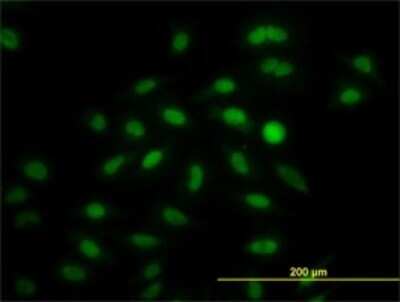 Immunocytochemistry/Immunofluorescence: IRF2 Antibody (3D6) [H00003660-M01] - Analysis of monoclonal antibody to IRF2 on HeLa cell. Antibody concentration 10 ug/ml.