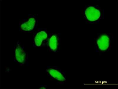 Immunocytochemistry/Immunofluorescence: IRF2 Antibody (7C2) [H00003660-M04] - Analysis of monoclonal antibody to IRF2 on HeLa cell. Antibody concentration 10 ug/ml