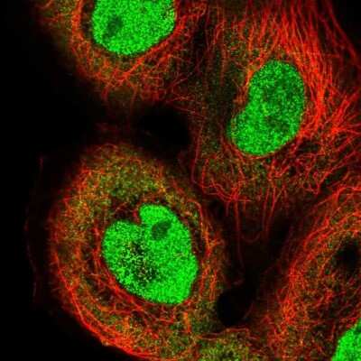 Immunocytochemistry/Immunofluorescence: IRF2 Antibody [NBP2-56712] - Staining of human cell line A-431 shows localization to nucleoplasm & cytosol.