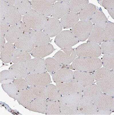 Immunohistochemistry-Paraffin: IRF2 Antibody [NBP1-89433] -  Staining of human skeletal muscle shows moderate to strong nuclear positivity in a subset of myocytes.