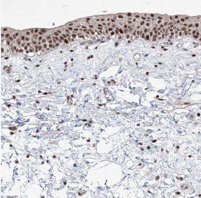 Immunohistochemistry-Paraffin: IRF2 Antibody [NBP1-89433] -  Staining of human urinary bladder shows strong nuclear positivity in urothelial cells.