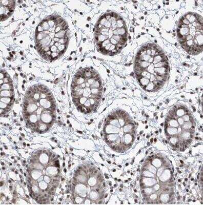 Immunohistochemistry-Paraffin: IRF2 Antibody [NBP1-89433] - Staining of human colon shows strong nuclear positivity in glandular cells.