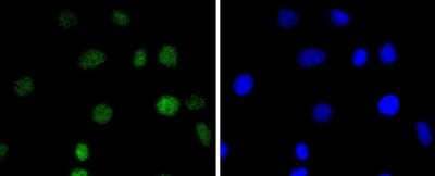 Immunocytochemistry/Immunofluorescence: IRF2 Antibody (JJ088-0) [NBP2-67870] - Staining IRF2 in A549 cells (green). The nuclear counter stain is DAPI (blue). Cells were fixed in paraformaldehyde, permeabilised with 0.25% Triton X100/PBS.