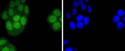 Immunocytochemistry/Immunofluorescence: IRF2 Antibody (JJ088-0) [NBP2-67870] - Staining IRF2 in Hela cells (green). The nuclear counter stain is DAPI (blue). Cells were fixed in paraformaldehyde, permeabilised with 0.25% Triton X100/PBS.