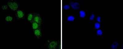 Immunocytochemistry/Immunofluorescence: IRF2 Antibody (JJ088-0) [NBP2-67870] - Staining IRF2 in PANC-1 cells (green). The nuclear counter stain is DAPI (blue). Cells were fixed in paraformaldehyde, permeabilised with 0.25% Triton X100/PBS.