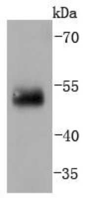 Western Blot: IRF2 Antibody (JJ088-0) [NBP2-67870] - Analysis of IRF2 on human lung lysates using anti-IRF2 antibody at 1/1,000 dilution.