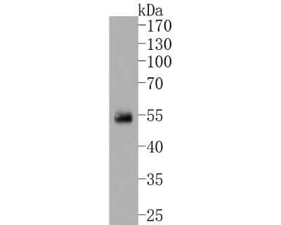 Western Blot: IRF2 Antibody (JJ088-0) [NBP2-67870] - Western blot analysis of IRF2 on human lung tissue lysates. Proteins were transferred to a PVDF membrane and blocked with 5% BSA in PBS for 1 hour at room temperature. The primary antibody (1/500) was used in 5% BSA at room temperature for 2 hours. Goat A