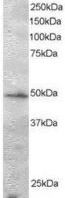 Western Blot: IRF2 Antibody [NB100-1089] - Staining (2ug/ml) of Jurkat lysate (RIPA buffer, 30ug total protein per lane). Primary incubated for 1 hour. Detected by western blot using chemiluminescence.