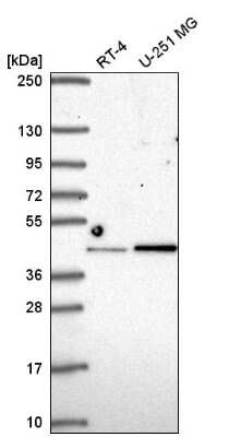 Western Blot: IRF2 Antibody [NBP2-56712] - Western blot analysis in human cell line RT-4 and human cell line U-251 MG.