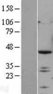 Western Blot: IRF2 Overexpression Lysate (Adult Normal) [NBL1-12031] Left-Empty vector transfected control cell lysate (HEK293 cell lysate); Right -Over-expression Lysate for IRF2.