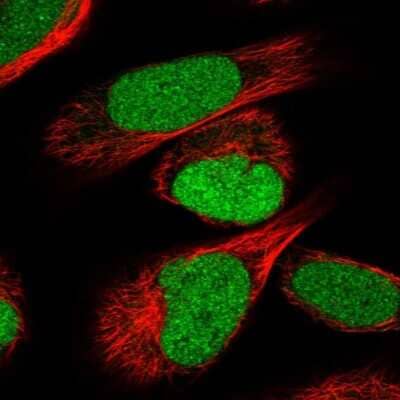 Immunocytochemistry/ Immunofluorescence IRF2BP2 Antibody