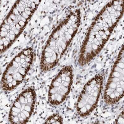 Immunohistochemistry-Paraffin: IRF2BP2 Antibody [NBP1-93674] - Staining of human colon shows strong nuclear positivity in glandular cells.