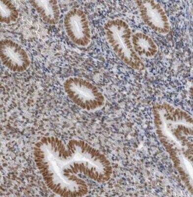 Immunohistochemistry-Paraffin IRF2BP2 Antibody