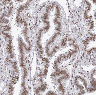 Immunohistochemistry-Paraffin: IRF2BP2 Antibody [NBP1-93674] - Staining of human fallopian tube shows moderate nuclear positivity in glandular cells.