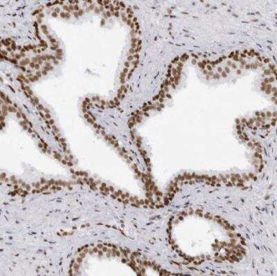 Immunohistochemistry-Paraffin: IRF2BP2 Antibody [NBP1-93674] - Staining of human prostate shows strong nuclear positivity in glandular cells.