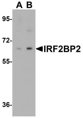 Western Blot: IRF2BP2 Antibody [NBP2-81996] - Western blot analysis of IRF2BP2 in HeLa cell lysate with IRF2BP2 antibody at 1 ug/mL in (A) the absence and (B) the presence of blocking peptide