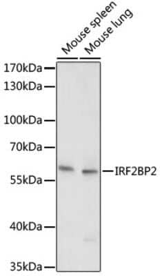 Western Blot: IRF2BP2 Antibody [NBP2-94463] - Analysis of extracts of various cell lines, using IRF2BP2 at 1:1000 dilution.Secondary antibody: HRP Goat Anti-Rabbit IgG (H+L) at 1:10000 dilution.Lysates/proteins: 25ug per lane.Blocking buffer: 3% nonfat dry milk in TBST.Detection: ECL Basic Kit .Exposure time: 5s.