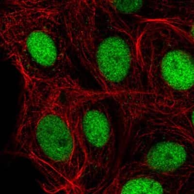 Immunocytochemistry/Immunofluorescence: IRF2BPL Antibody [NBP2-56241] - Staining of human cell line MCF7 shows localization to nucleoplasm. Antibody staining is shown in green.