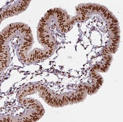 Immunohistochemistry-Paraffin: IRF2BPL Antibody [NBP2-14712] - Staining of human fallopian tube shows strong nuclear positivity in glandular cells.
