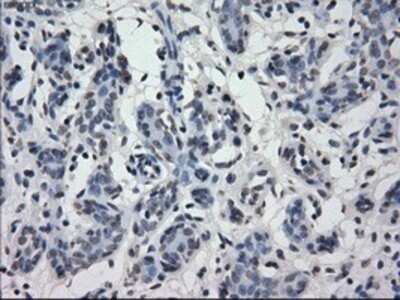 Immunohistochemistry: IRF3 Antibody (OTI2G3) - Azide and BSA Free [NBP2-71042] - Staining of paraffin-embedded breast tissue using anti-IRF3 mouse monoclonal antibody.