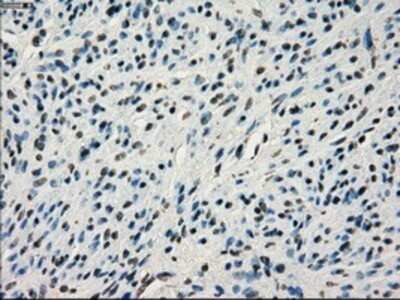 Immunohistochemistry: IRF3 Antibody (OTI2G3) - Azide and BSA Free [NBP2-71042] - Staining of paraffin-embedded endometrium tissue using anti-IRF3 mouse monoclonal antibody.