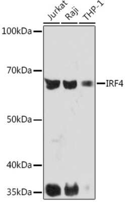 Western Blot: IRF4 Antibody (2U3G10) [NBP3-16591] - Western blot analysis of extracts of various cell lines, using IRF4 Rabbit mAb (NBP3-16591) at 1:1000 dilution. Secondary antibody: HRP Goat Anti-Rabbit IgG (H+L) at 1:10000 dilution. Lysates/proteins: 25ug per lane. Blocking buffer: 3% nonfat dry milk in TBST. Detection: ECL Basic Kit. Exposure time: 90s.