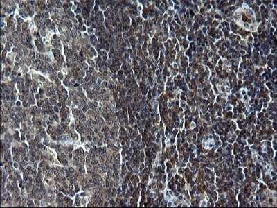 Immunohistochemistry: IRF5 Antibody (OTI1G7) - Azide and BSA Free [NBP2-71043] - Analysis of Human lymph node tissue. (Heat-induced epitope retrieval by 1 mM EDTA in 10mM Tris, pH8.5, 120C for 3min)