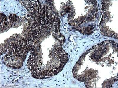 Immunohistochemistry: IRF5 Antibody (OTI1G7) - Azide and BSA Free [NBP2-71043] - Analysis of Human prostate tissue. (Heat-induced epitope retrieval by 1 mM EDTA in 10mM Tris, pH8.5, 120C for 3min)