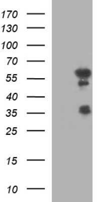 Western Blot: IRF5 Antibody (OTI1G7) - Azide and BSA Free [NBP2-71043] - Analysis of HEK293T cells were transfected with the pCMV6-ENTRY control (Left lane) or pCMV6-ENTRY IRF5.