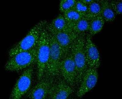 Immunocytochemistry/Immunofluorescence: IRF5 Antibody (SD203-07) [NBP2-67742] - Staining IRF5 in HepG2 cells (green). The nuclear counter stain is DAPI (blue). Cells were fixed in paraformaldehyde, permeabilised with 0.25% Triton X100/PBS.