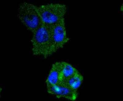 Immunocytochemistry/Immunofluorescence: IRF5 Antibody (SD203-07) [NBP2-67742] - Staining IRF5 in RH-35 cells (green). The nuclear counter stain is DAPI (blue). Cells were fixed in paraformaldehyde, permeabilised with 0.25% Triton X100/PBS.