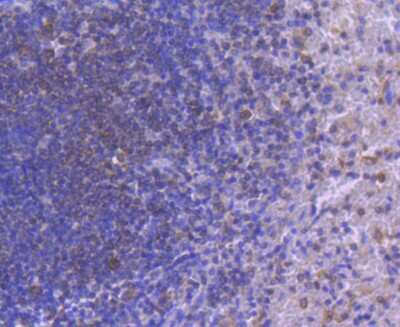 Immunohistochemistry-Paraffin: IRF5 Antibody (SD203-07) [NBP2-67742] - Analysis of paraffin-embedded human spleen tissue using anti-IRF5 antibody. Counter stained with hematoxylin.