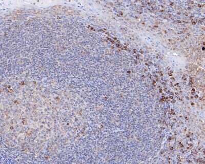 Immunohistochemistry-Paraffin: IRF5 Antibody (SN201-05) [NBP2-67730] - Immunohistochemical analysis of paraffin-embedded human tonsil tissue using anti-IRF5 antibody. The section was pre-treated using heat mediated antigen retrieval with sodium citrate buffer (pH 6.0) for 20 minutes. The tissues were blocked in 5% BSA for 30 minutes at room temperature, washed with ddH2O and PBS, and then probed with the primary antibody (1/200) for 30 minutes at room temperature. The detection was performed using an HRP conjugated compact polymer system. DAB was used as the chromogen. Tissues were counterstained with hematoxylin and mounted with DPX.