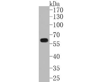 Western Blot: IRF5 Antibody (SN201-05) [NBP2-67730] - Western blot analysis of IRF5 on THP-1 cell lysates. Proteins were transferred to a PVDF membrane and blocked with 5% BSA in PBS for 1 hour at room temperature. The primary antibody (1/500) was used in 5% BSA at room temperature for 2 hours. Goat Anti-Rab