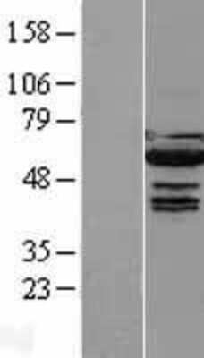 Western Blot: IRF5 Overexpression Lysate (Adult Normal) [NBL1-12034] Left-Empty vector transfected control cell lysate (HEK293 cell lysate); Right -Over-expression Lysate for IRF5.