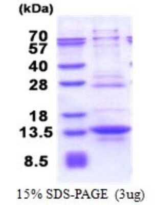 SDS-Page: IRF5 Recombinant Protein [NBP2-51630] - 15% SDS Page (3 ug)