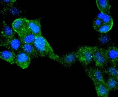 Immunocytochemistry/Immunofluorescence: IRF6 Antibody (SD202-6) [NBP2-67765] - Staining IRF6 in 293 cells (green). The nuclear counter stain is DAPI (blue). Cells were fixed in paraformaldehyde, permeabilised with 0.25% Triton X100/PBS.