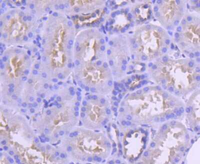 Immunohistochemistry-Paraffin: IRF6 Antibody (SD202-6) [NBP2-67765] - Analysis of paraffin-embedded human kidney tissue using anti-IRF6 antibody. Counter stained with hematoxylin.