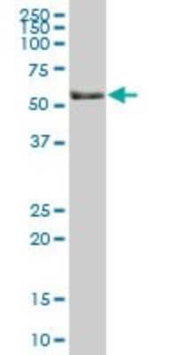 Western Blot: IRF6 Antibody [H00003664-B01P] - Analysis of IRF6 expression in human colon.