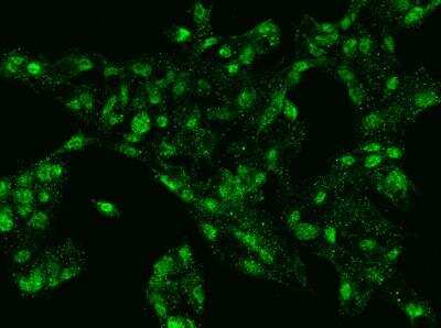 Immunocytochemistry/Immunofluorescence: IRF8 Antibody [NBP2-99595] - Staining of IRF8 in HepG2 cells. Cells were fixed with 4% PFA, permeabilzed with 0.1% Triton X-100 in PBS,blocked with 10% serum, and incubated with rabbit anti-human IRF8 polyclonal antibody (dilution ratio 1:1000) at 4? overnight. Then cells were stained with the Alexa Fluor®488-conjugated Goat Anti-rabbit IgG secondary antibody (green). Positive staining was localized to Nucleus .