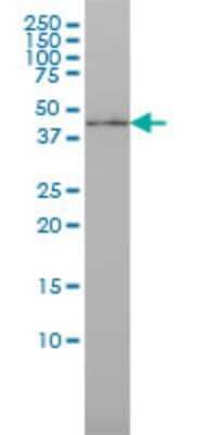 Western Blot: IRF9 Antibody (1D11) [H00010379-M02] - ISGF3G monoclonal antibody (M02), clone 1D11 Analysis of ISGF3G expression in MCF-7.