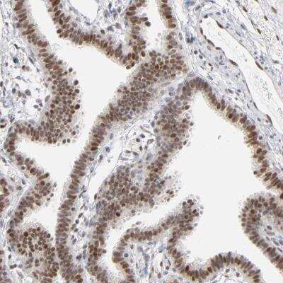 Immunohistochemistry-Paraffin: IRF9 Antibody [NBP1-81577] - Staining of human fallopian tube shows moderate nuclear positivity in glandular cells.